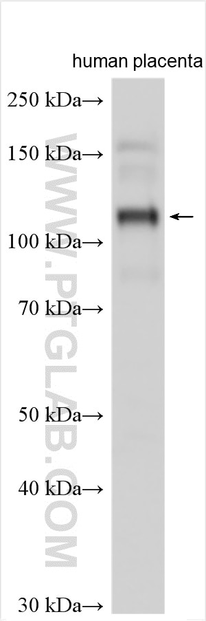 WB analysis using 24890-1-AP