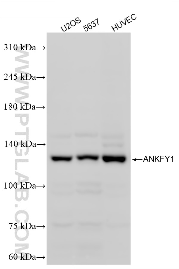Western Blot (WB) analysis of various lysates using ANKFY1 Recombinant monoclonal antibody (87415-1-RR)