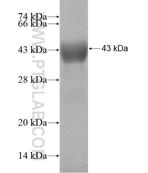 ANKFY1 fusion protein Ag19267 SDS-PAGE