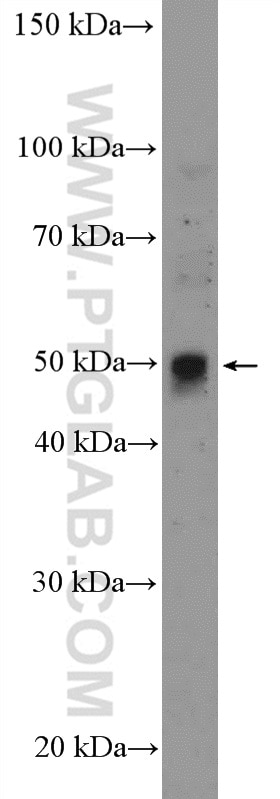 Western Blot (WB) analysis of HEK-293T cells using ANKH Polyclonal antibody (20303-1-AP)