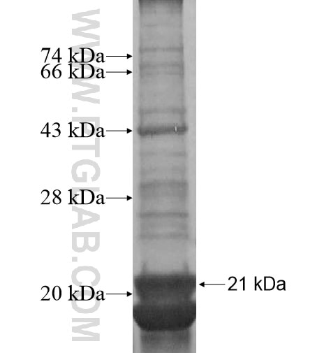 ANKH fusion protein Ag14568 SDS-PAGE