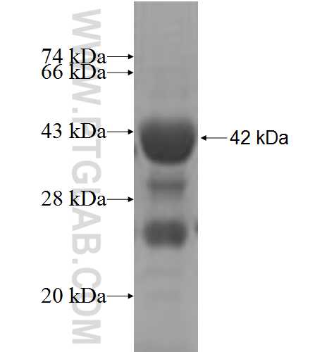 ANKHD1 fusion protein Ag4289 SDS-PAGE