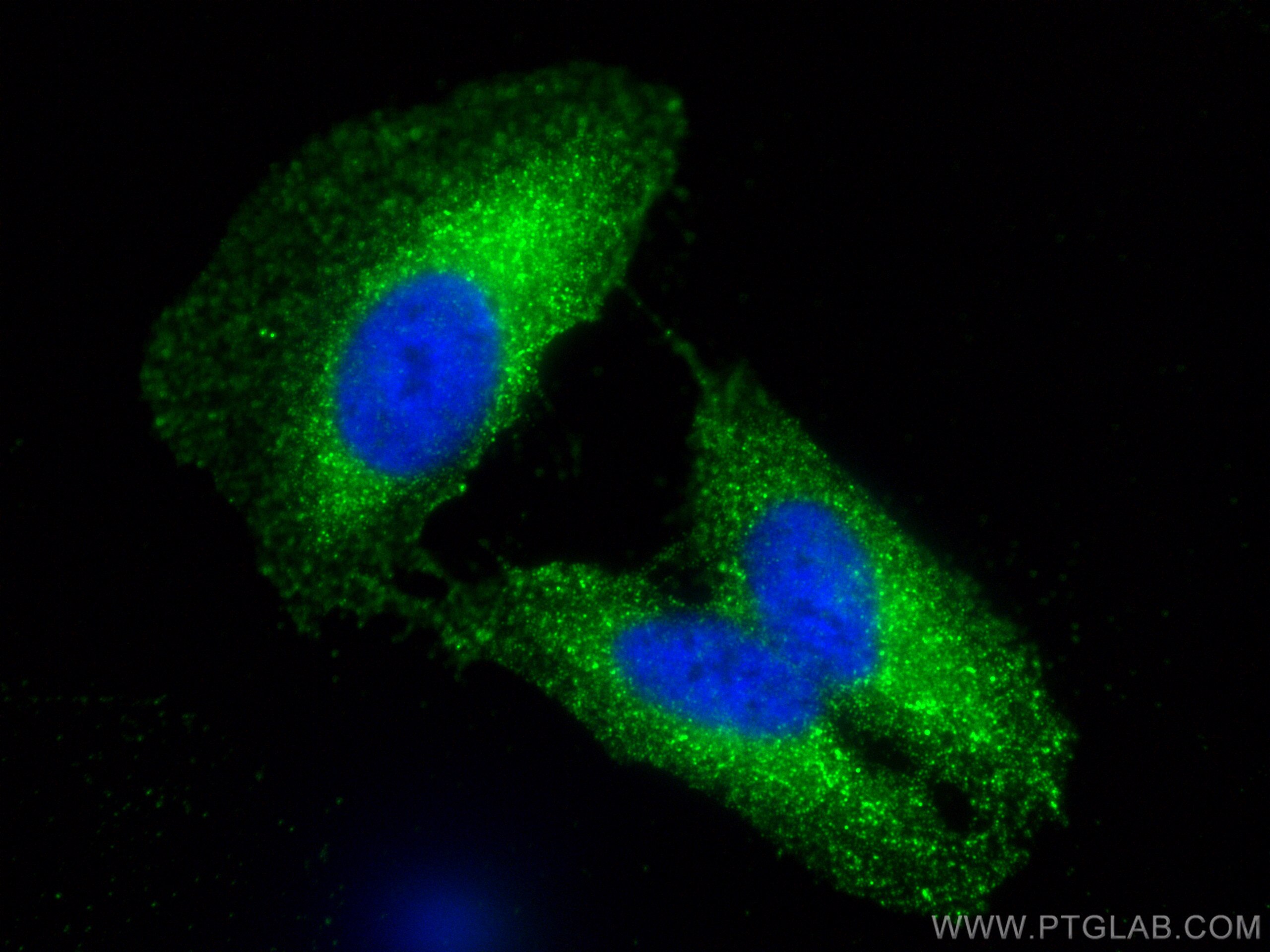 Immunofluorescence (IF) / fluorescent staining of U2OS cells using ANKIB1 Polyclonal antibody (30467-1-AP)
