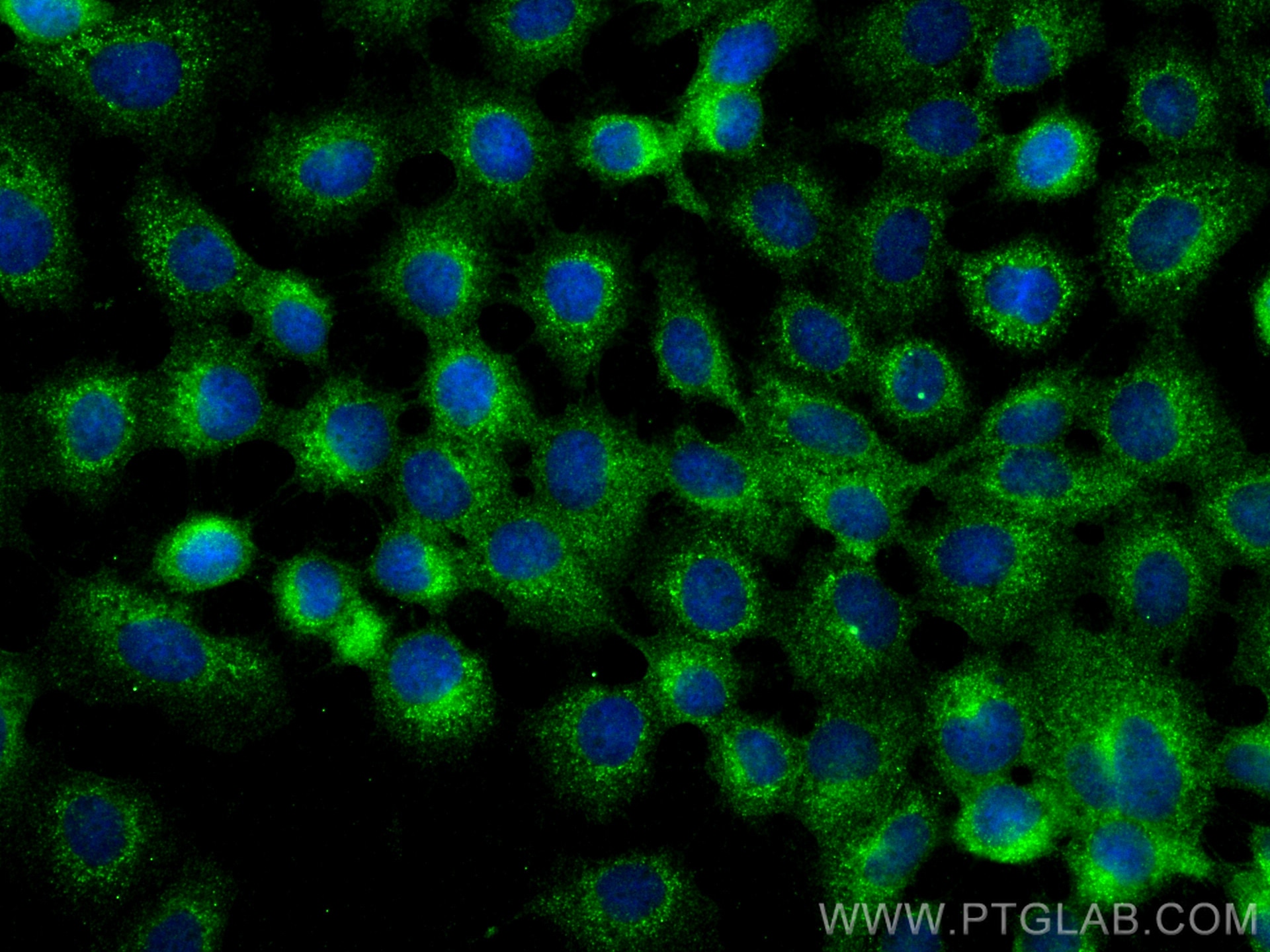 Immunofluorescence (IF) / fluorescent staining of A431 cells using ANKIB1 Polyclonal antibody (30467-1-AP)