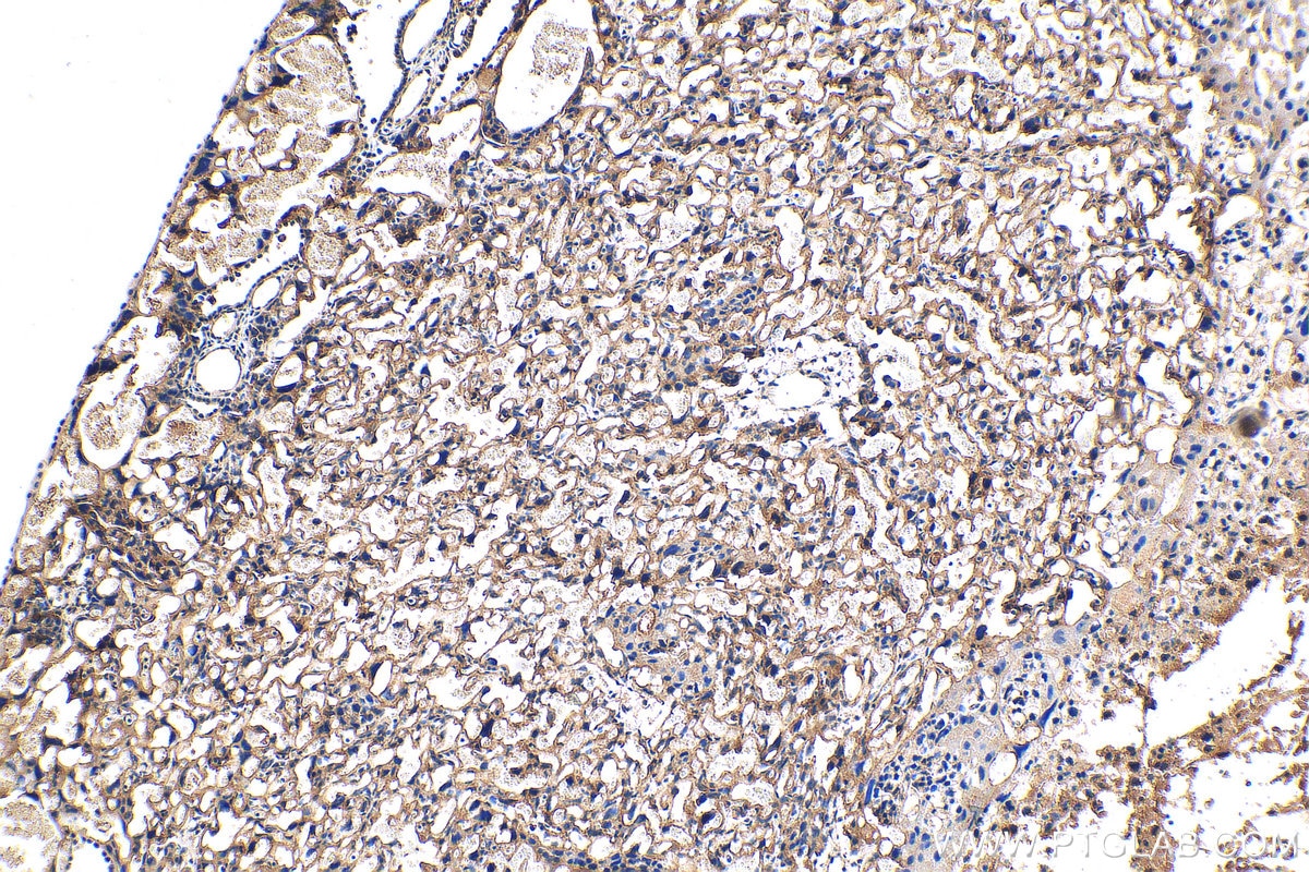 Immunohistochemistry (IHC) staining of mouse placenta tissue using ANKIB1 Polyclonal antibody (30467-1-AP)