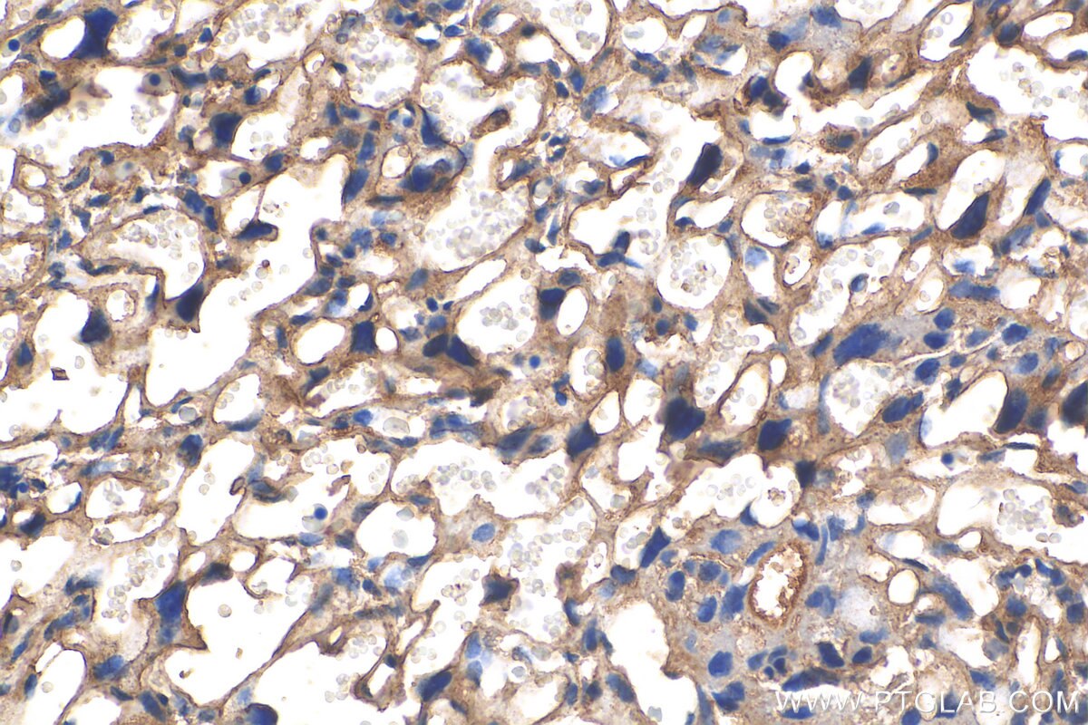 Immunohistochemistry (IHC) staining of mouse placenta tissue using ANKIB1 Polyclonal antibody (30467-1-AP)