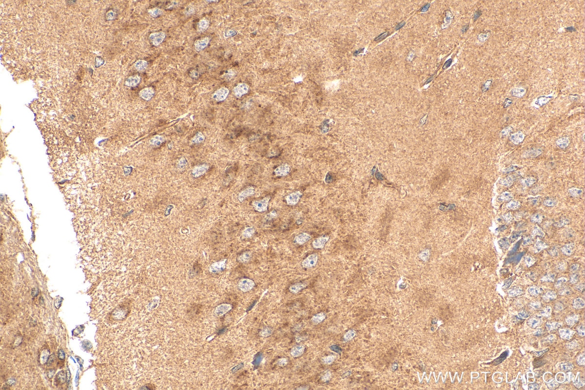 Immunohistochemistry (IHC) staining of mouse brain tissue using ANKIB1 Polyclonal antibody (30467-1-AP)