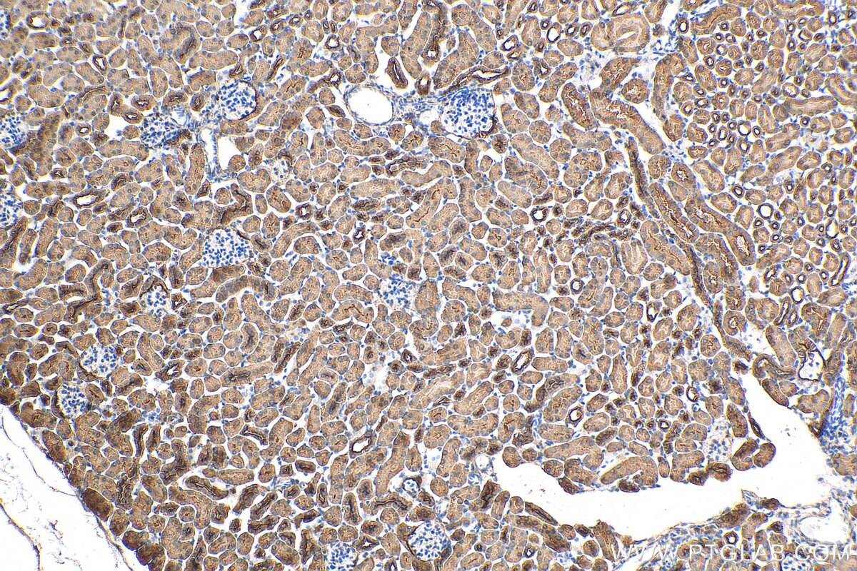 Immunohistochemistry (IHC) staining of mouse kidney tissue using ANKIB1 Polyclonal antibody (30467-1-AP)