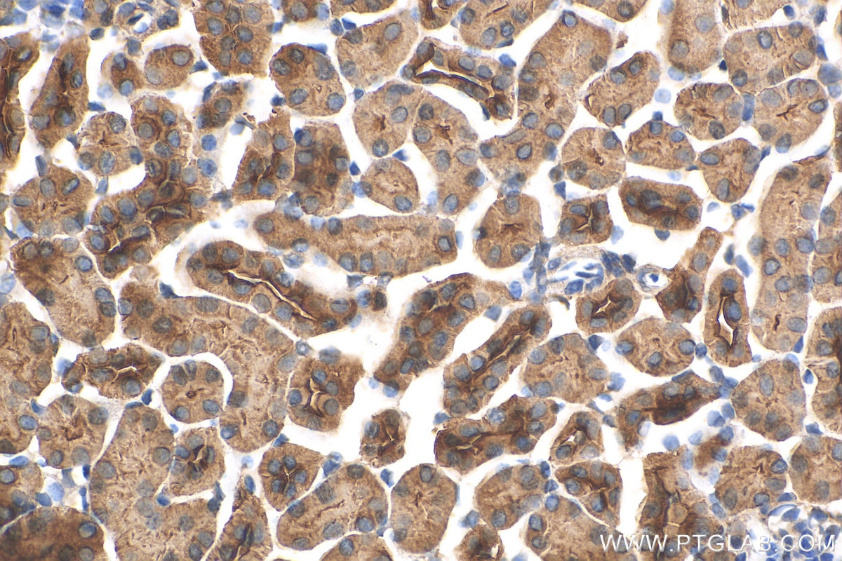 Immunohistochemistry (IHC) staining of mouse kidney tissue using ANKIB1 Polyclonal antibody (30467-1-AP)
