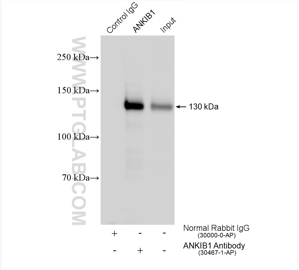 Immunoprecipitation (IP) experiment of HeLa cells using ANKIB1 Polyclonal antibody (30467-1-AP)