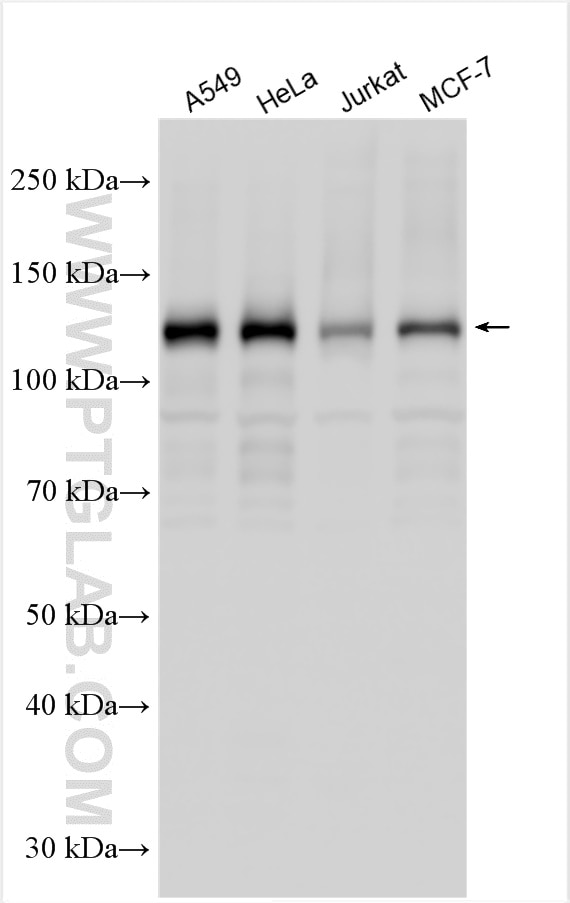Western Blot (WB) analysis of various lysates using ANKIB1 Polyclonal antibody (30467-1-AP)