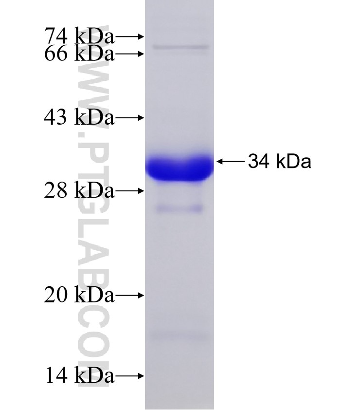 ANKIB1 fusion protein Ag32935 SDS-PAGE