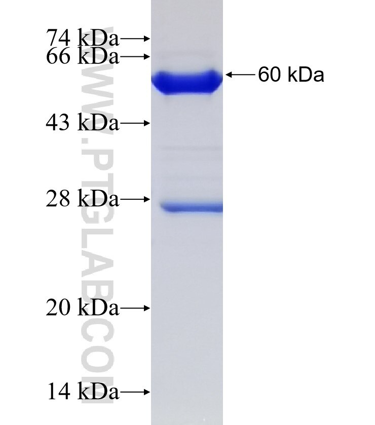 ANKIB1 fusion protein Ag33126 SDS-PAGE