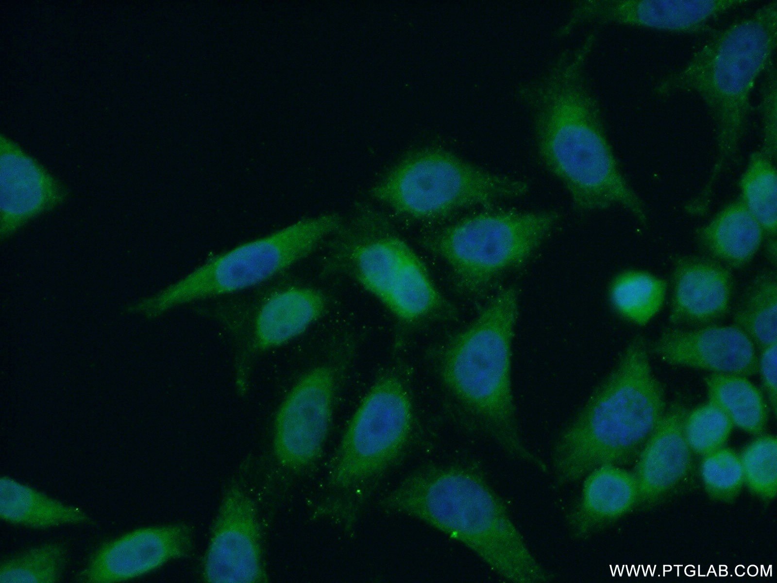 Immunofluorescence (IF) / fluorescent staining of HeLa cells using ANKLE1 Polyclonal antibody (24080-1-AP)
