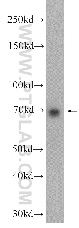 Western Blot (WB) analysis of K-562 cells using ANKLE1 Polyclonal antibody (24080-1-AP)