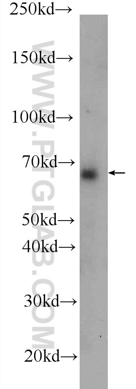Western Blot (WB) analysis of HeLa cells using ANKLE1 Polyclonal antibody (24080-1-AP)