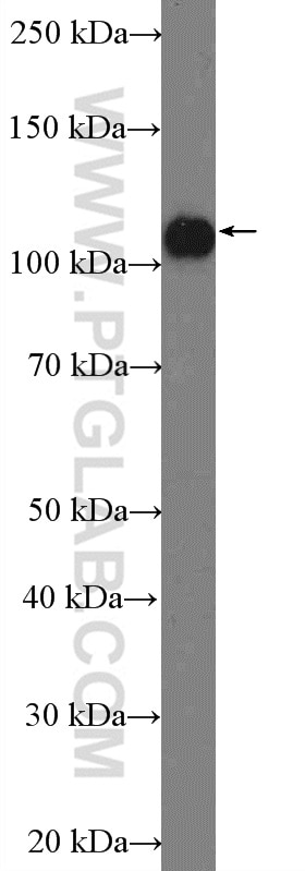 Western Blot (WB) analysis of HeLa cells using ANKLE2 Polyclonal antibody (26293-1-AP)