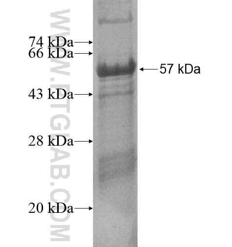 ANKMY1 fusion protein Ag15020 SDS-PAGE