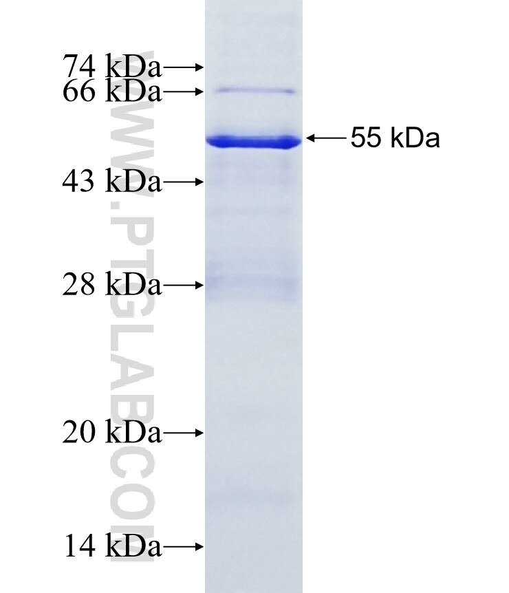 ANKMY1 fusion protein Ag15020 SDS-PAGE ANKMY1 fusion protein Ag15020 SDS-PAGE
