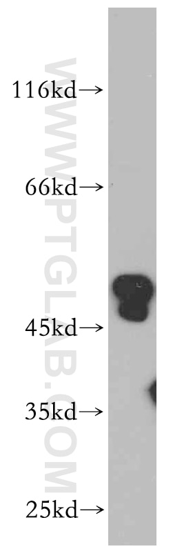Western Blot (WB) analysis of HeLa cells using ANKMY2 Polyclonal antibody (21065-1-AP)