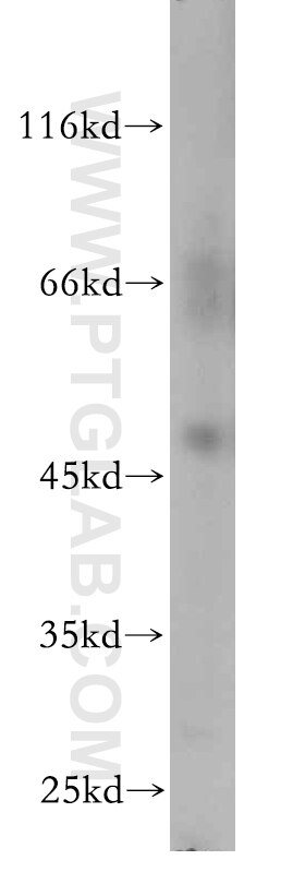 WB analysis of mouse liver using 21065-1-AP