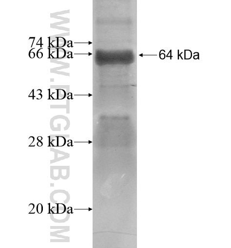 ANKMY2 fusion protein Ag15185 SDS-PAGE