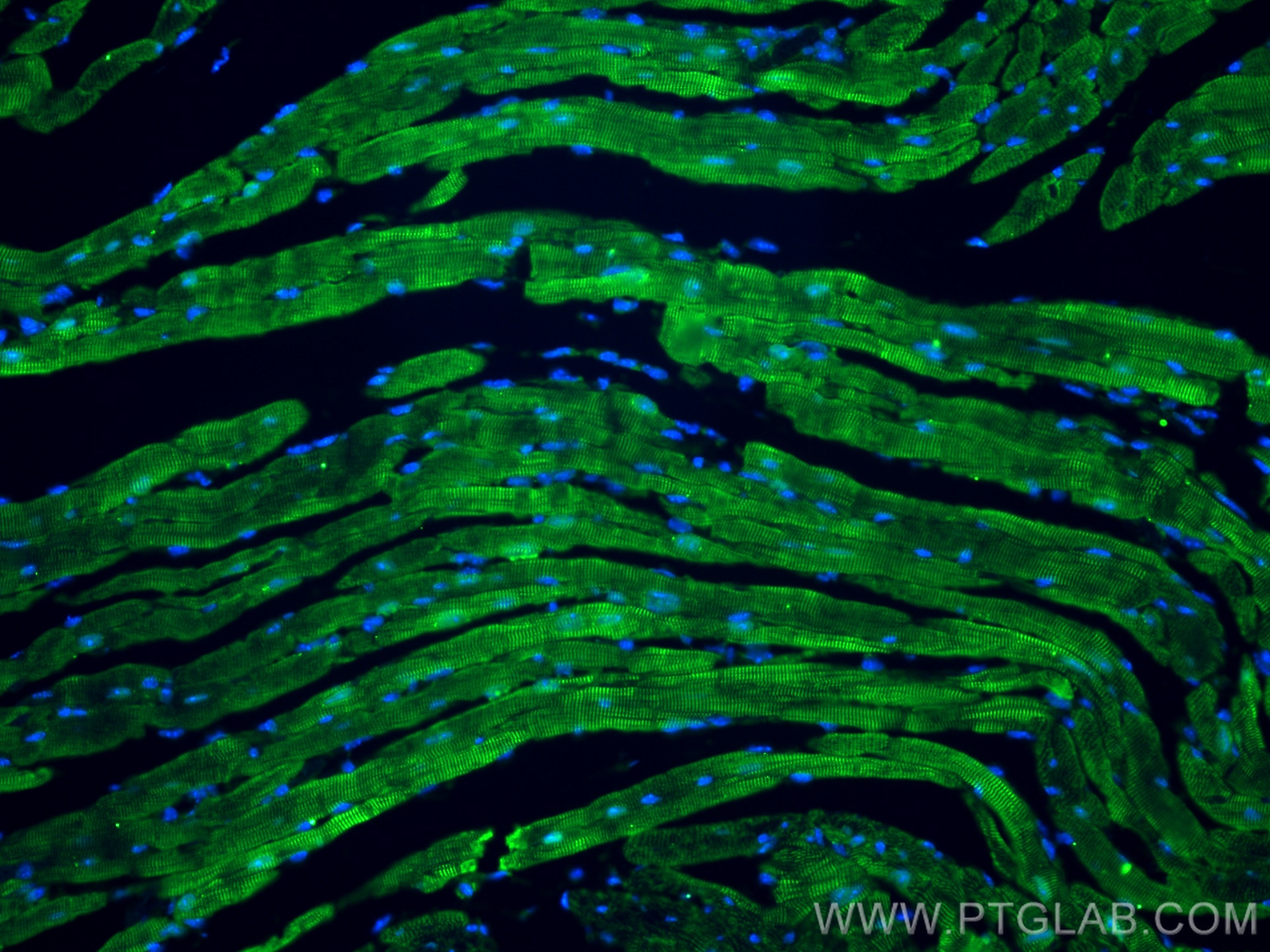 Immunofluorescence (IF) / fluorescent staining of mouse heart tissue using ANKRD1 Polyclonal antibody (11427-1-AP)