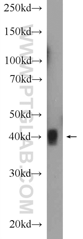 Western Blot (WB) analysis of rat skeletal muscle tissue using ANKRD1 Polyclonal antibody (11427-1-AP)