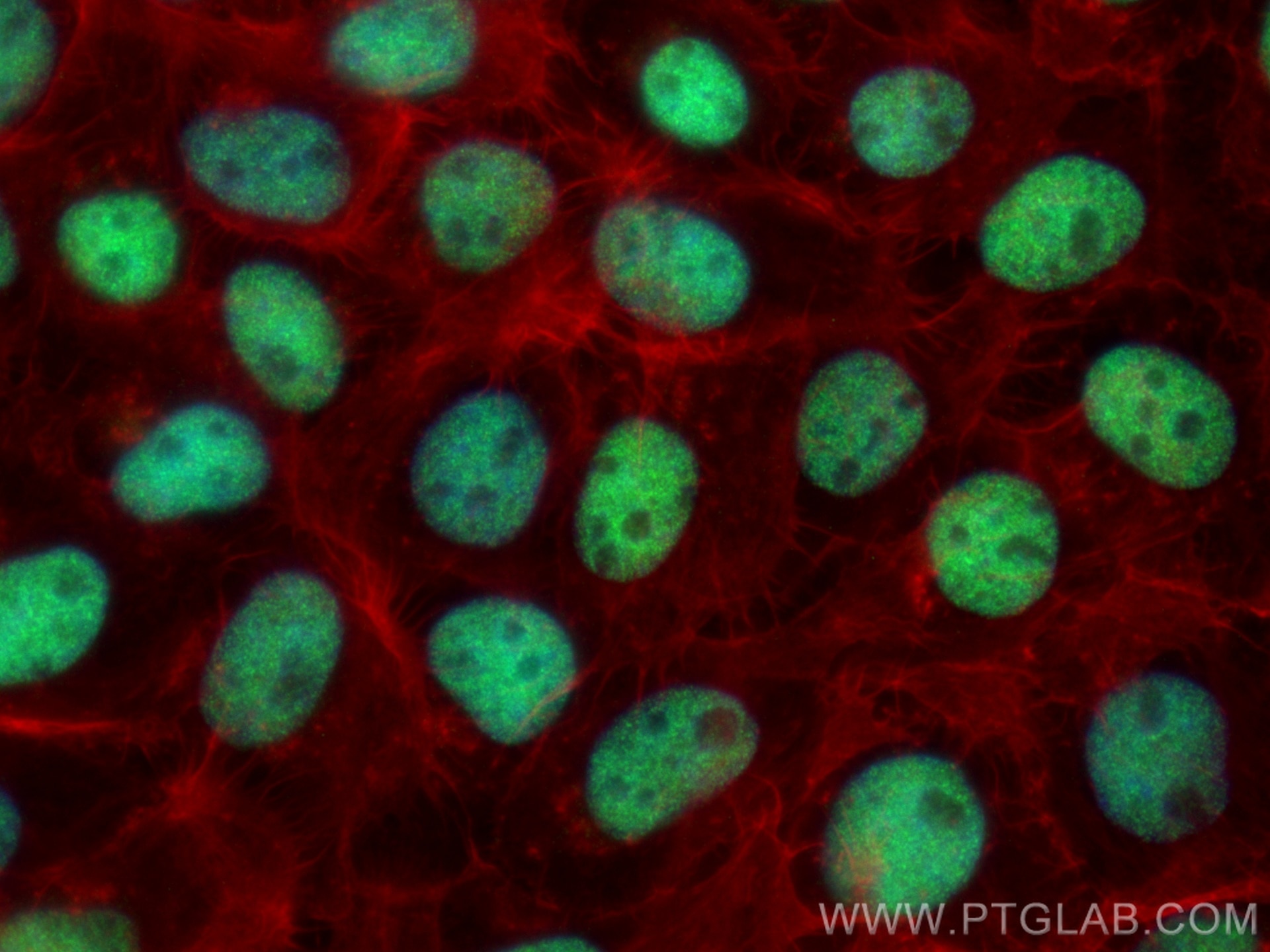 Immunofluorescence (IF) / fluorescent staining of A431 cells using ANKRD1 Monoclonal antibody (67775-1-Ig)