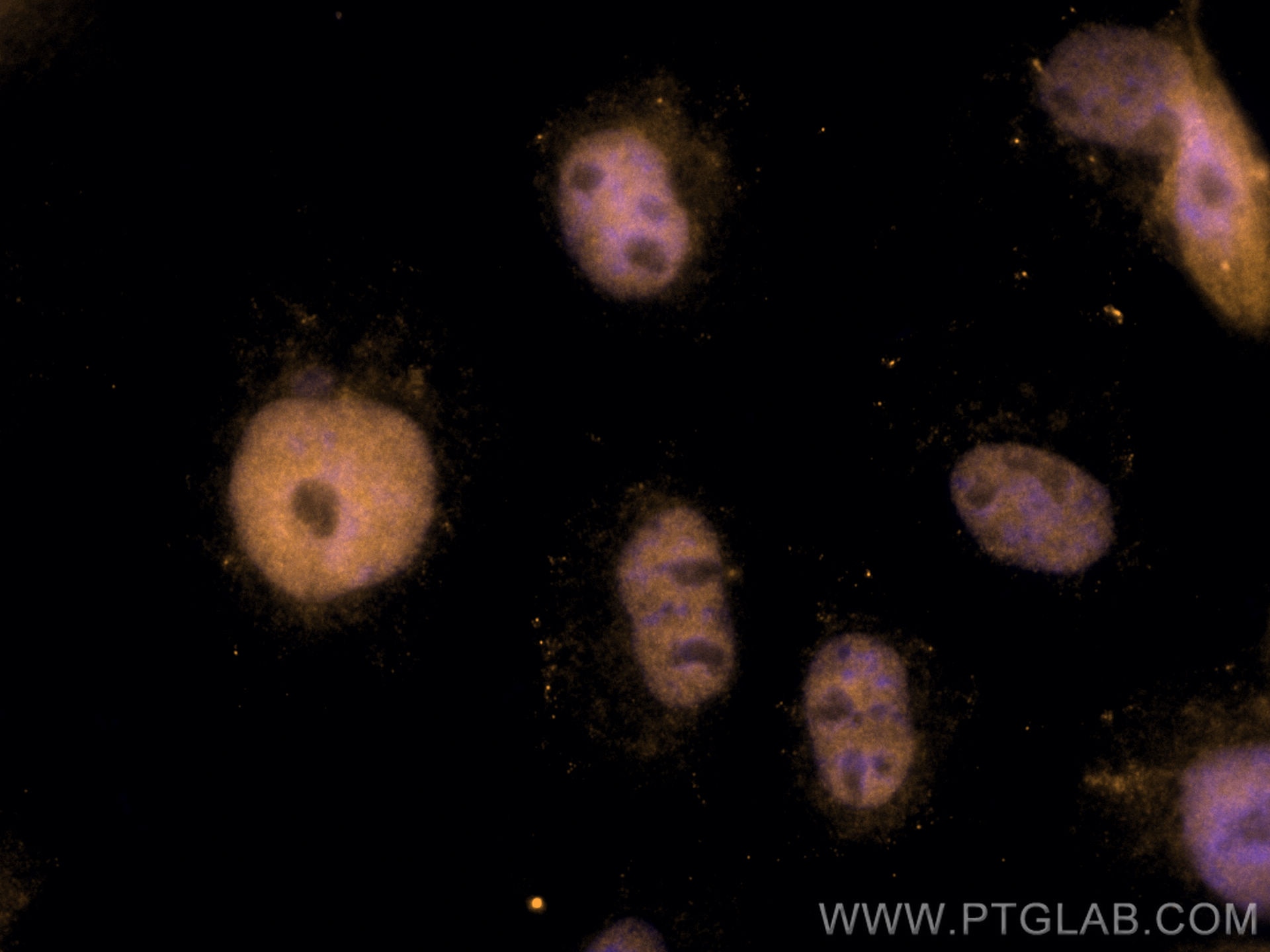 Immunofluorescence (IF) / fluorescent staining of A431 cells using CoraLite® Plus 555-conjugated ANKRD1 Monoclonal an (CL555-67775)