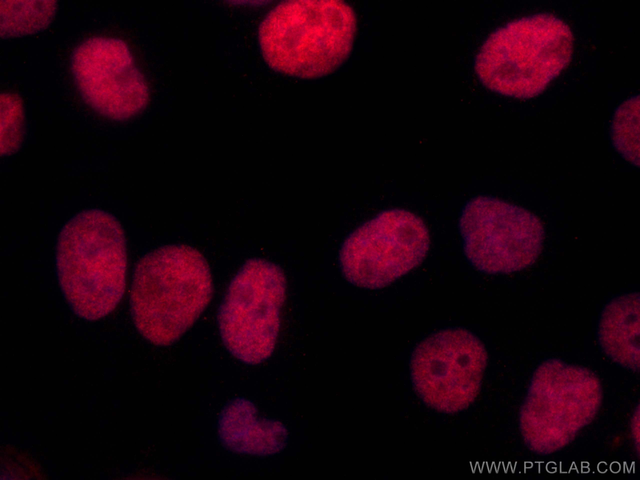 Immunofluorescence (IF) / fluorescent staining of A431 cells using CoraLite®594-conjugated ANKRD1 Monoclonal antibody (CL594-67775)