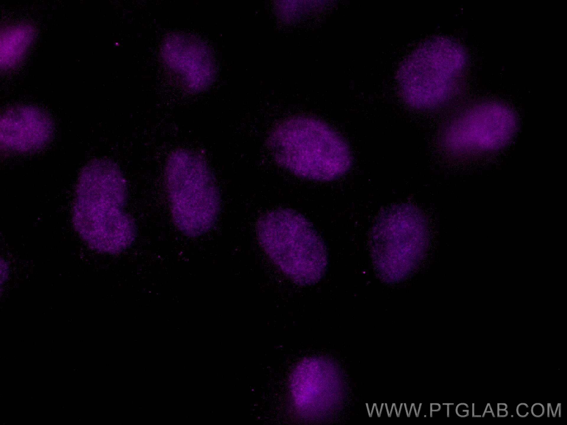Immunofluorescence (IF) / fluorescent staining of A431 cells using CoraLite® Plus 647-conjugated ANKRD1 Monoclonal an (CL647-67775)