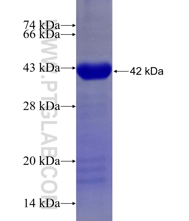 ANKRD1 fusion protein Ag29974 SDS-PAGE