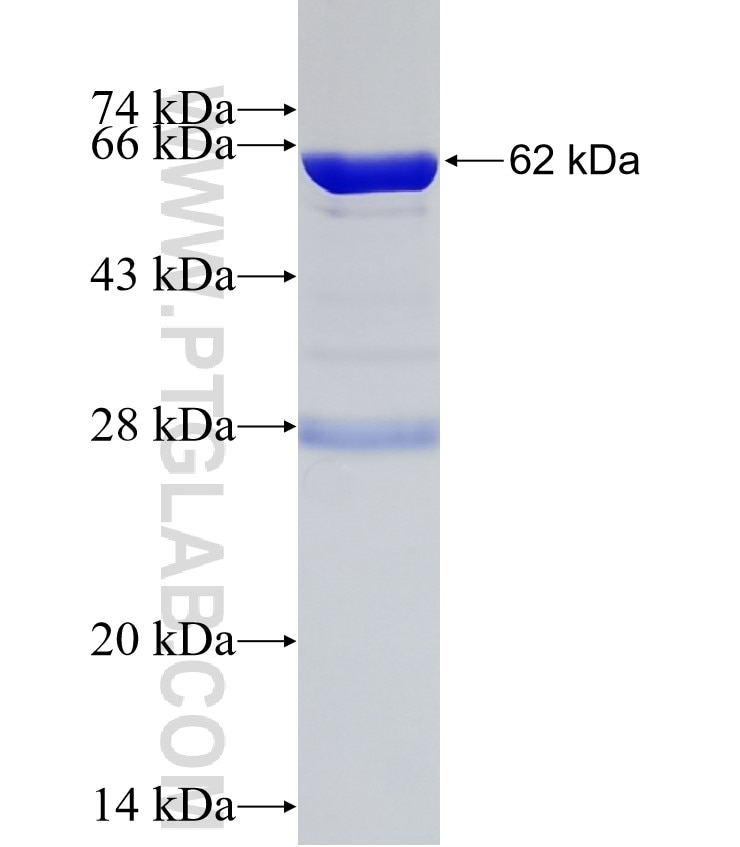 ANKRD1 fusion protein Ag1970 SDS-PAGE
