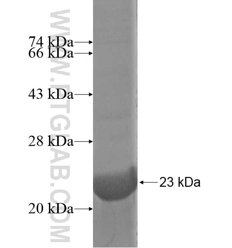 ANKRD10 fusion protein Ag14866 SDS-PAGE