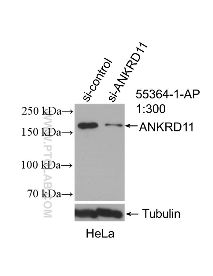 Western Blot (WB) analysis of HeLa cells using ANKRD11 Polyclonal antibody (55364-1-AP)