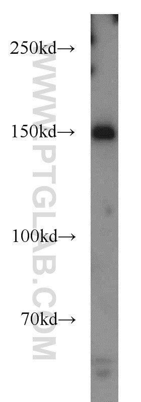 WB analysis of HeLa using 55364-1-AP