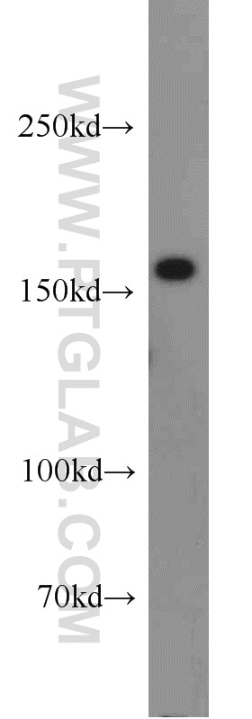 Western Blot (WB) analysis of HeLa cells using ANKRD11 Polyclonal antibody (55364-1-AP)