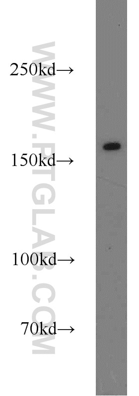 Western Blot (WB) analysis of BxPC-3 cells using ANKRD11 Polyclonal antibody (55364-1-AP)