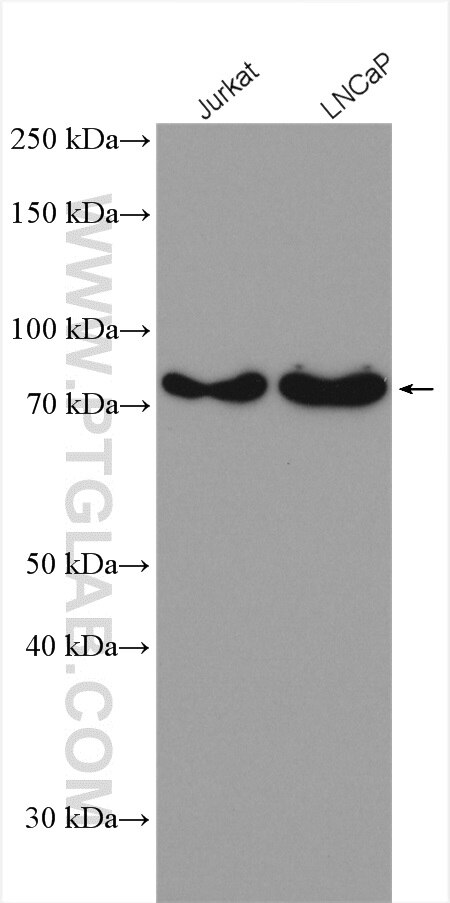 Western Blot (WB) analysis of various lysates using ANKRD13A Polyclonal antibody (23998-1-AP)