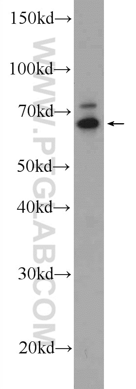 Western Blot (WB) analysis of HepG2 cells using ANKRD13A Polyclonal antibody (23998-1-AP)