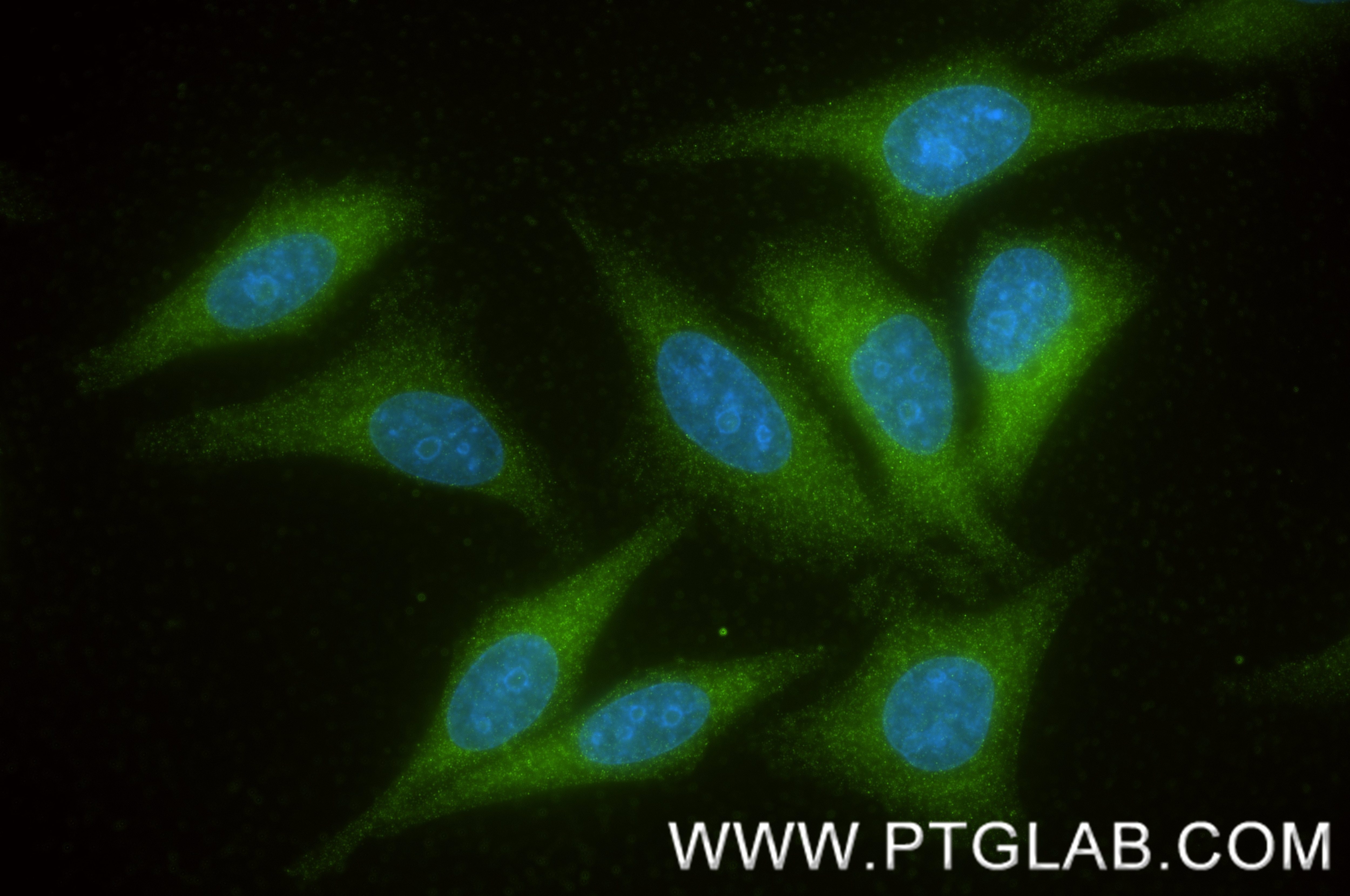 IF Staining of HepG2 using 87239-1-RR (same clone as 87239-1-PBS) Immunofluorescence (IF) / fluorescent staining of HepG2 cells using ANKRD13A Recombinant monoclonal antibody (87239-1-RR)
