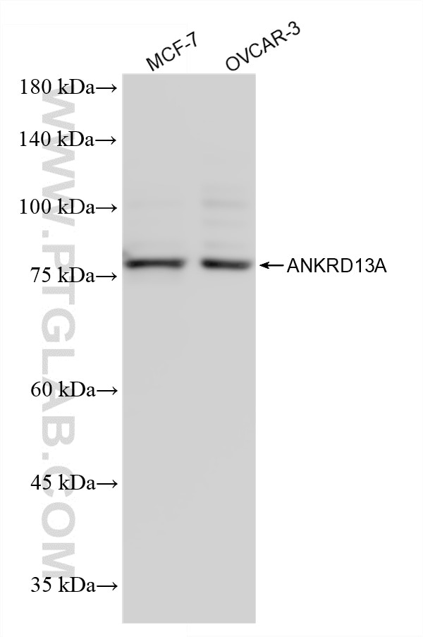 Western Blot (WB) analysis of various lysates using ANKRD13A Recombinant monoclonal antibody (87239-1-RR)