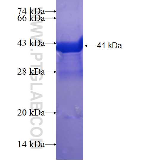 ANKRD13A fusion protein Ag21200 SDS-PAGE