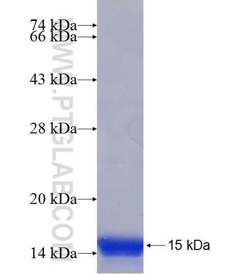 ANKRD13A fusion protein Ag21255 SDS-PAGE