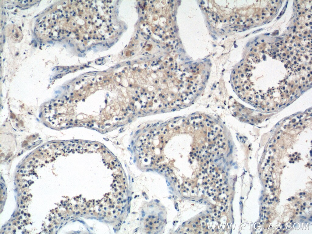 Immunohistochemistry (IHC) staining of human testis tissue using ANKRD13B Polyclonal antibody (25737-1-AP)