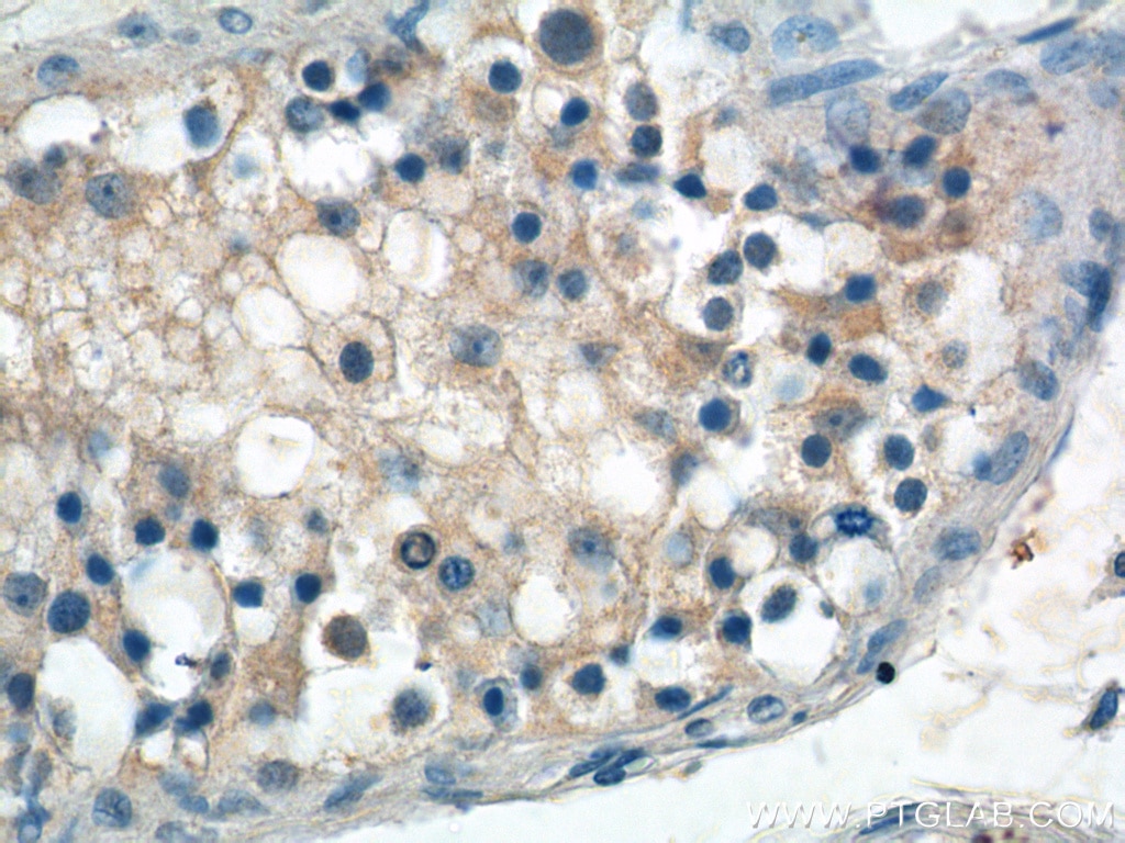 Immunohistochemistry (IHC) staining of human testis tissue using ANKRD13B Polyclonal antibody (25737-1-AP)