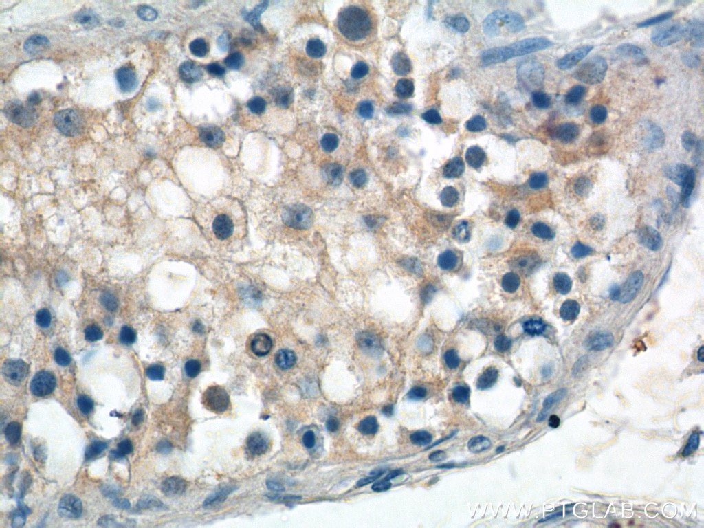 IHC staining of human testis using 25737-1-AP