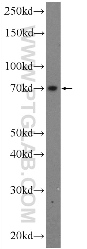 Western Blot (WB) analysis of mouse small intestine tissue using ANKRD13B Polyclonal antibody (25737-1-AP)