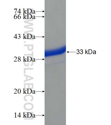 ANKRD13B fusion protein Ag22732 SDS-PAGE